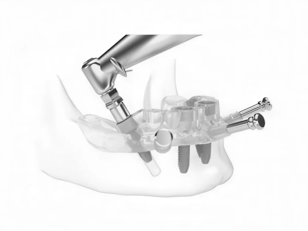 хирургический шаблон