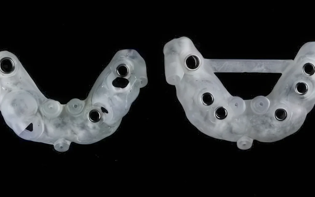 Хирургические шаблоны