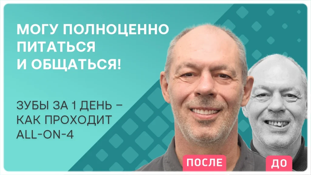 Видео отзыв после имплантации зубов - пациент Игорь Владимирович
