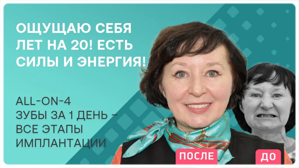 Видео отзыв после имплантации зубов - пациент Вера Валентиновна